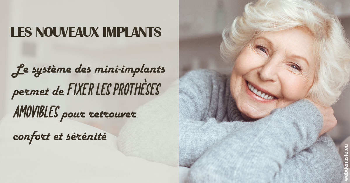 https://selas-du-dr-colas.chirurgiens-dentistes.fr/Les nouveaux implants 1