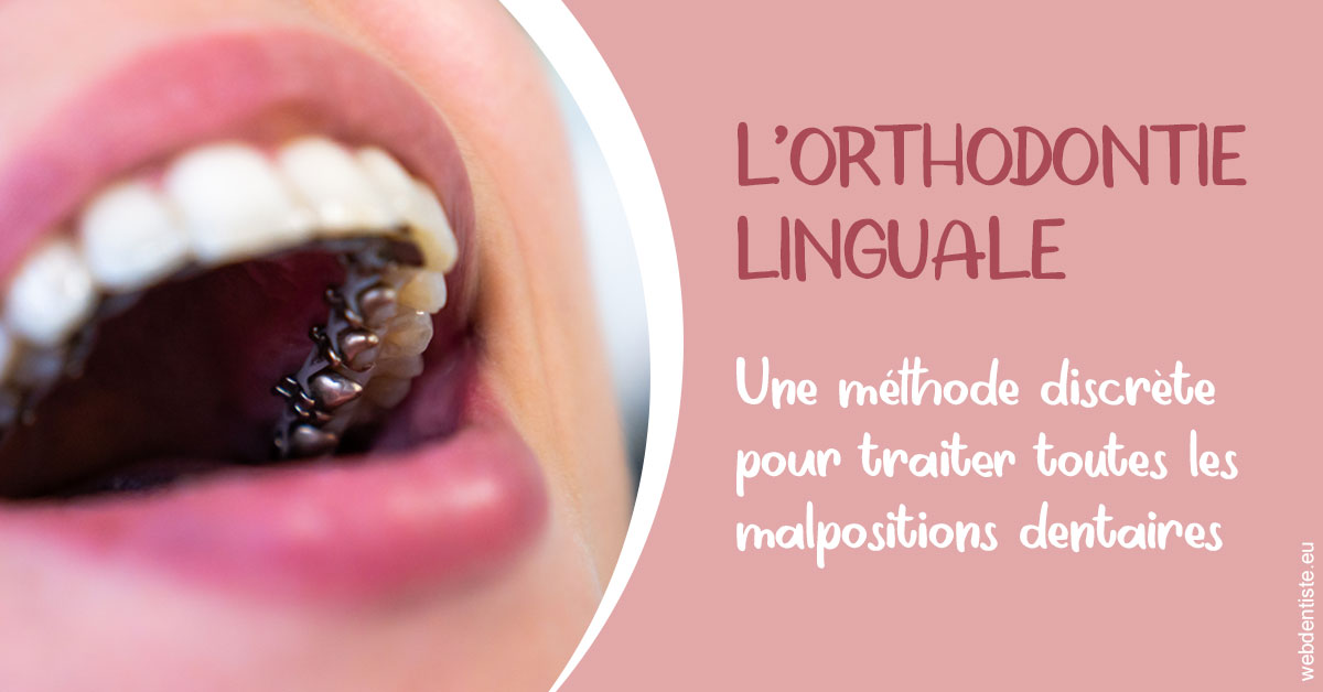 https://selas-du-dr-colas.chirurgiens-dentistes.fr/L'orthodontie linguale 2