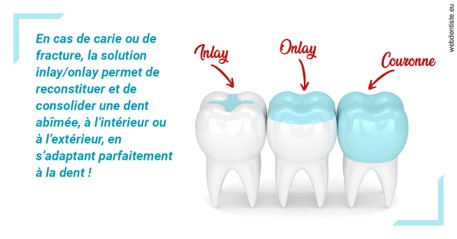 https://selas-du-dr-colas.chirurgiens-dentistes.fr/L'INLAY ou l'ONLAY