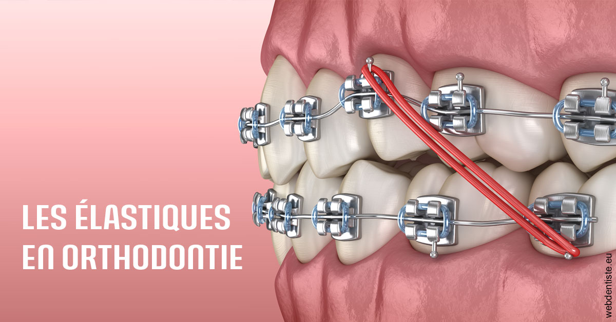 https://selas-du-dr-colas.chirurgiens-dentistes.fr/Elastiques orthodontie 2